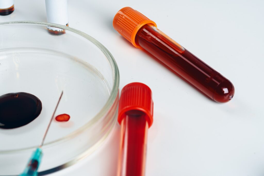 A close up of a blood test analysis.