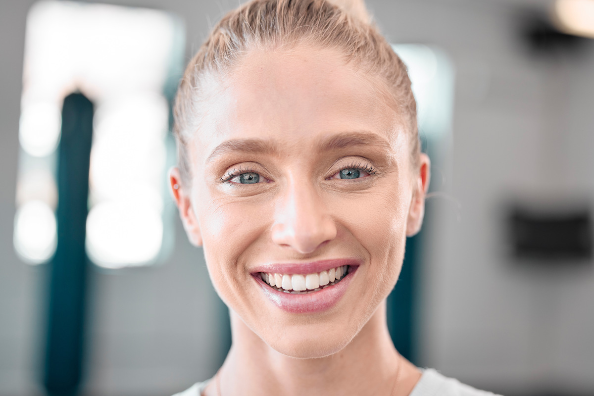 A woman is smiling after her non-surgical face lift in Mt. Pleasant, SC.