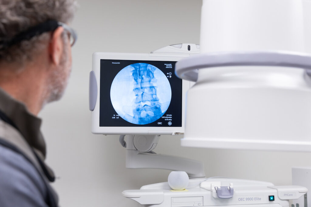 An InterveneMD medical expert is looking at a monitor while he adminsters prolotherapy in Mt. Pleasant, SC, for back pain.