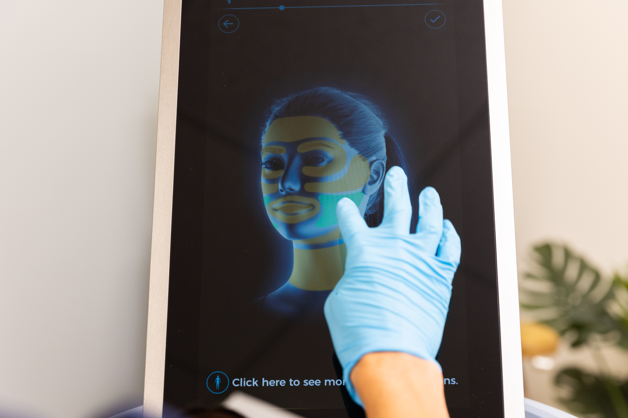 An InterveneMD provider is pairing Emface with exosomes in Mt. Pleasant.