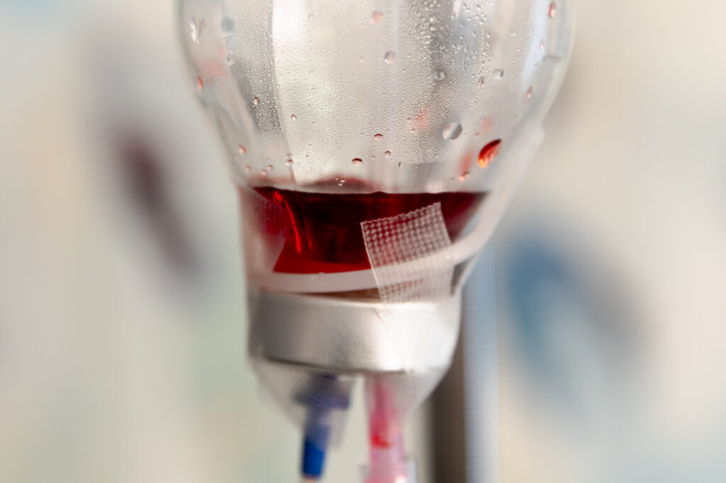 IV with ozone treatment dripping